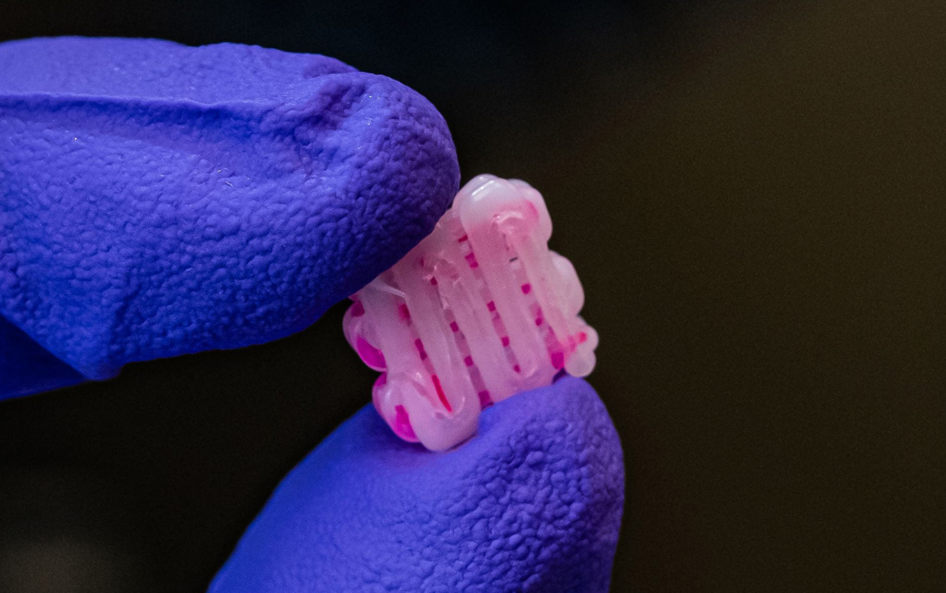 AI could expand healing with bioscaffolds